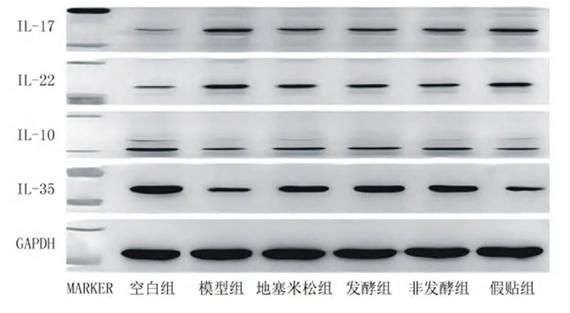 空白组和支气管哮喘各组大鼠肺组织中IL－17、IL－22、IL－10、IL－35蛋白表达电泳图